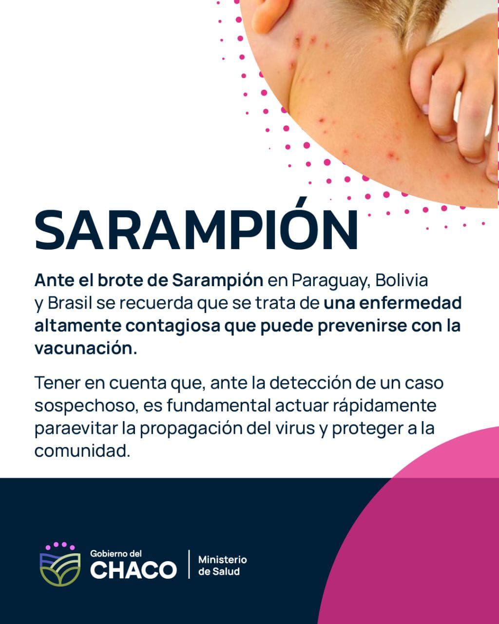 CHACO LIBRE DE SARAMPIÓN: SALUD REFORZÓ LA VIGILANCIA Y LLAMÓ A COMPLETAR VACUNAS